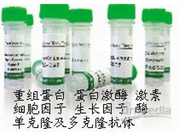 MouseAntiHumanHexokinase-1（HK1）