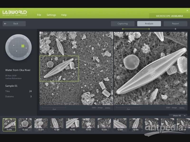 DiatomAI 全自动硅藻检验